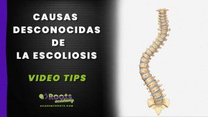 Escoliosis Causas no tan conocidas