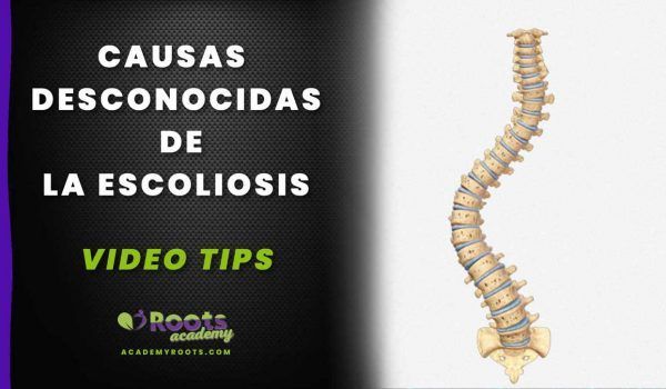 Escoliosis Causas no tan conocidas