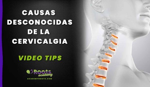 Roots-cuello--CERVICALGIA