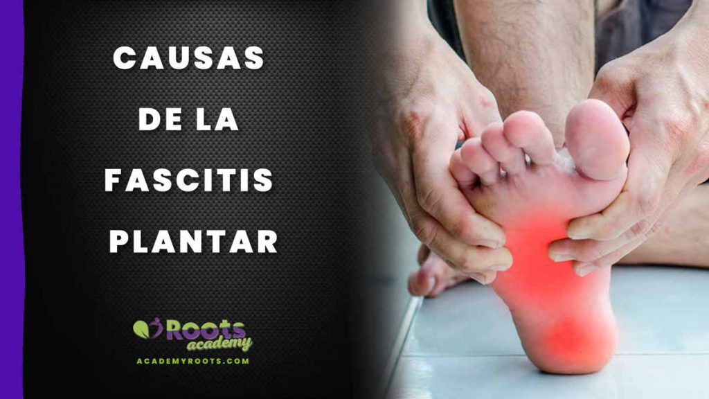 FASCITIS-PLANTAR