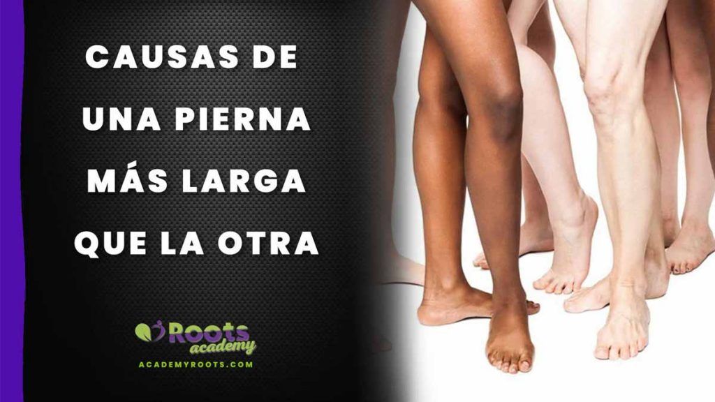 Roots--UNA-PIERNA-MAS-LARGA-QUE-OTRA